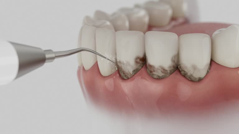 Trusted Teeth Cleaning And Checkup service in Mathews, LA - Dentist Open Now